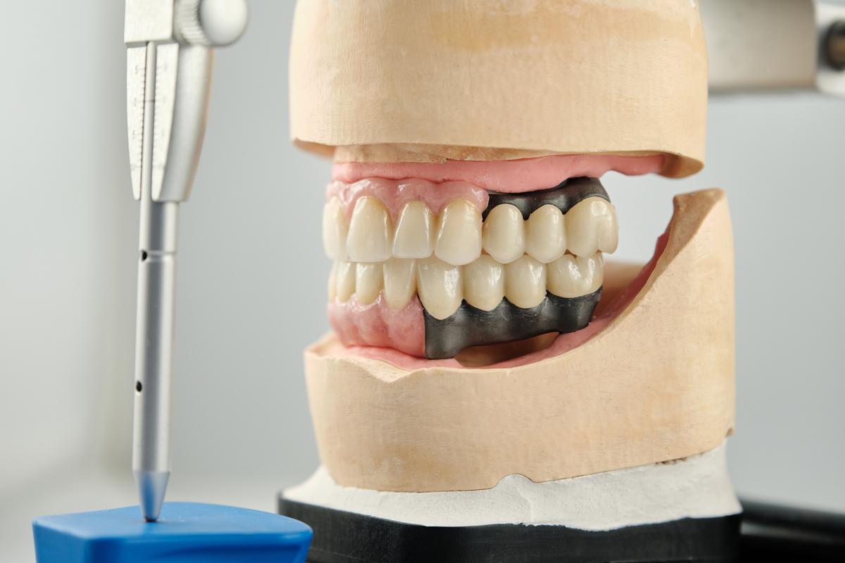 dentiste spécialisé en implantologie