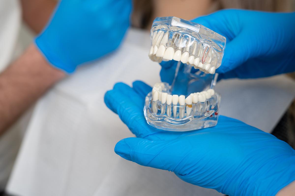 dentiste spécialisé en implantologie