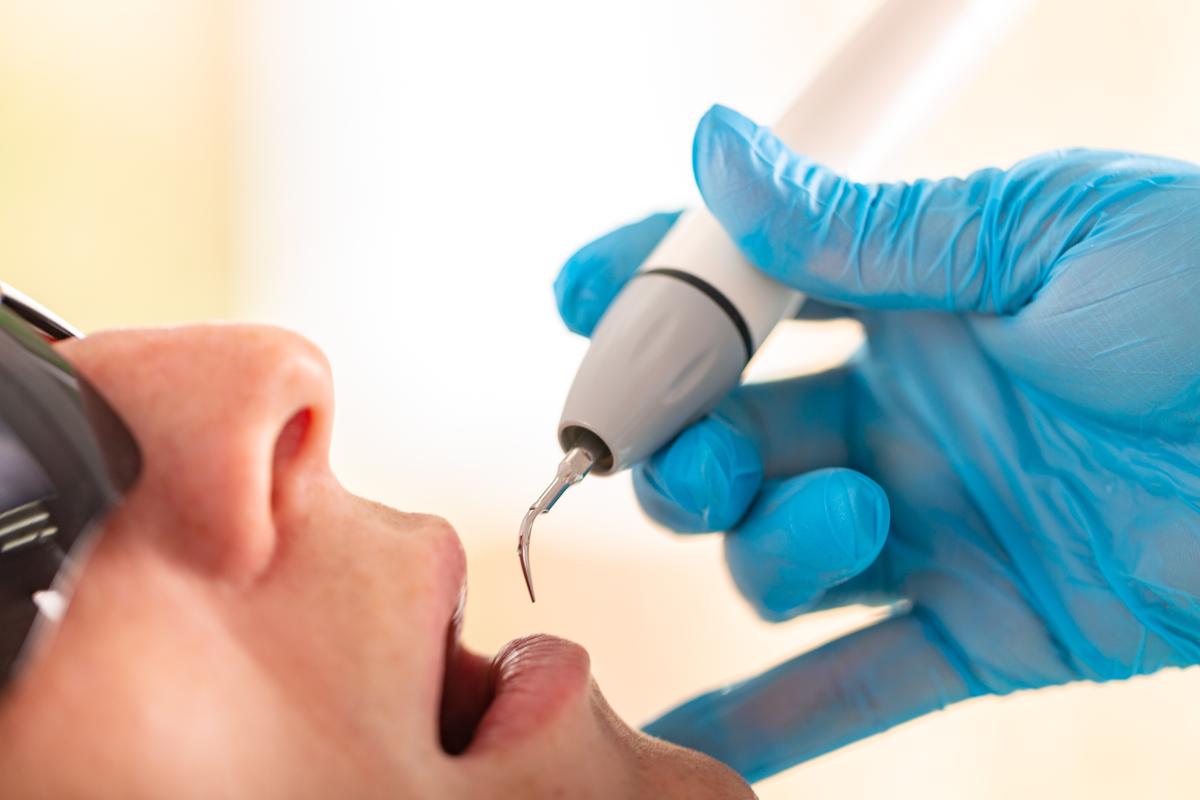 Prophylaxie dentiste